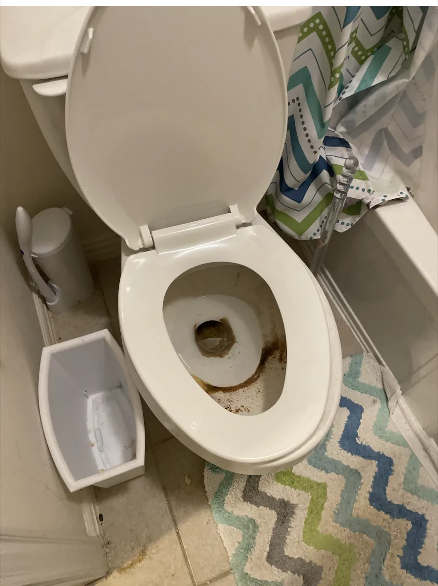 Toilet before cleaning